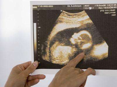 新一代香港驗血技術可提前7天便知胎兒性別