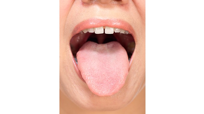 舌苔发白怎么办