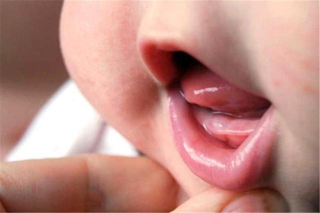 宝宝出牙的时间、症状表现以及注意事项,一篇讲清,宝妈要了解