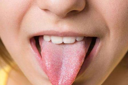 舌苔厚白是怎么回事 为什么婴儿会出现舌苔厚白情况