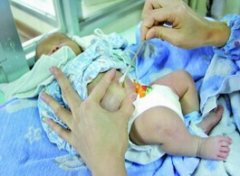 【新生儿脐带护理】新生儿脐带护理方法_新生儿脐带护理注意事项